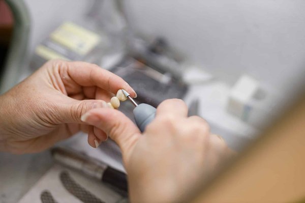 ¿Cuáles son los signos de que mi conejo tiene los dientes demasiado largos y cómo recortarlos?